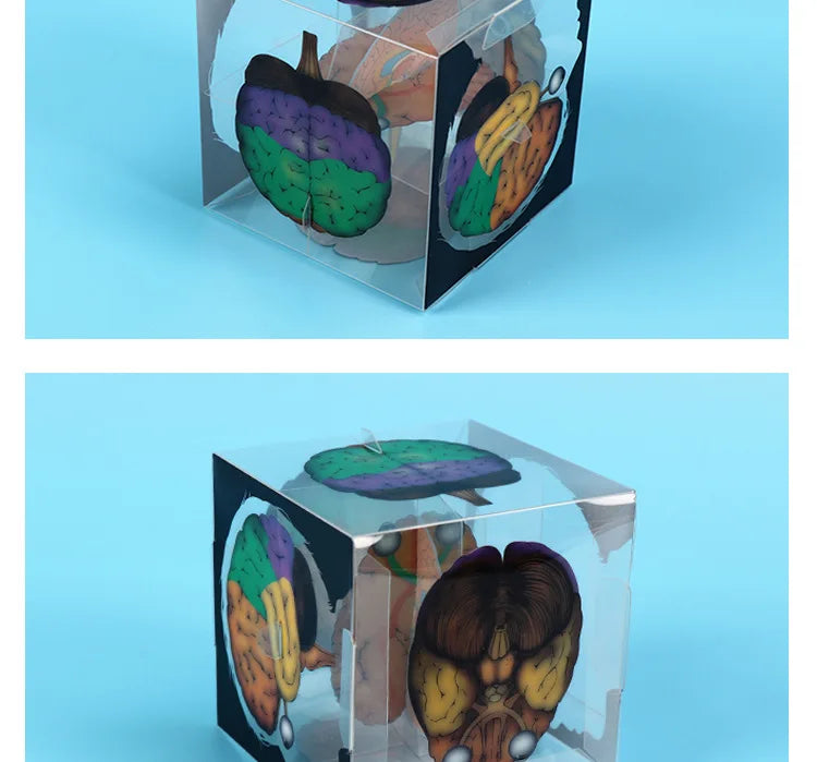 Brain and Optic Nerve 3D Cube | Free Shipping